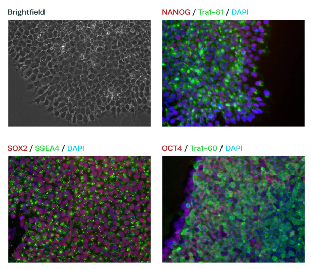 iPS cells were assessed for standard pluripotency markers