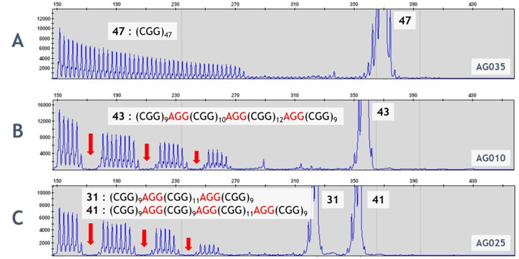 AGG Analysis for FMR1