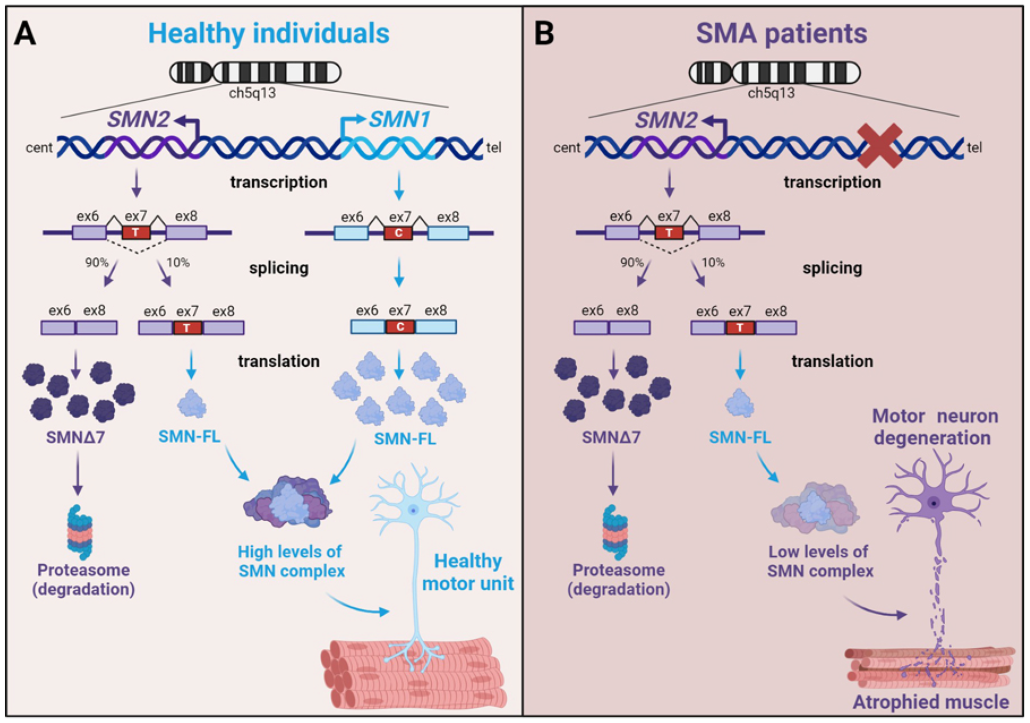 Spinal Muscular Atrophy ​