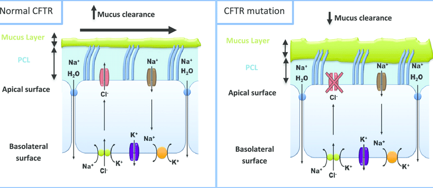 CFTR (Cystic Fibrosis)